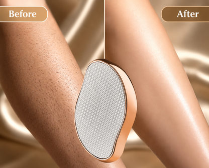 SilkErase – Crystal Hair Removal Tool